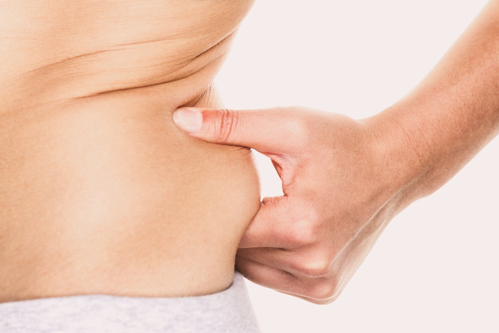 A close-up shot of a woman pinching her love handle before liposuction
