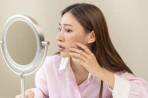 Acne Medications Lincoln Park IL