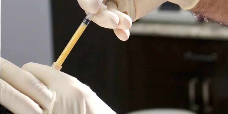 Facial fat grafting procedure at Old Town Med Spa.