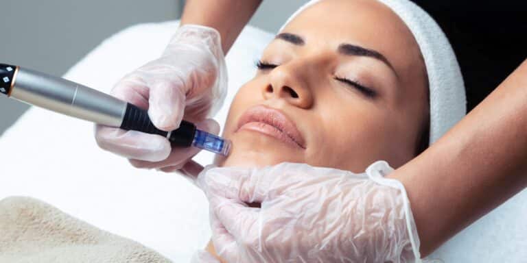 Microneedling procedure at Old Town Med Spa.